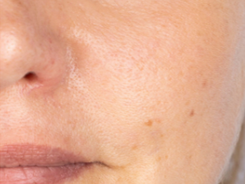 After EMS facial massage roller routine for smoother and more radiant-looking skin