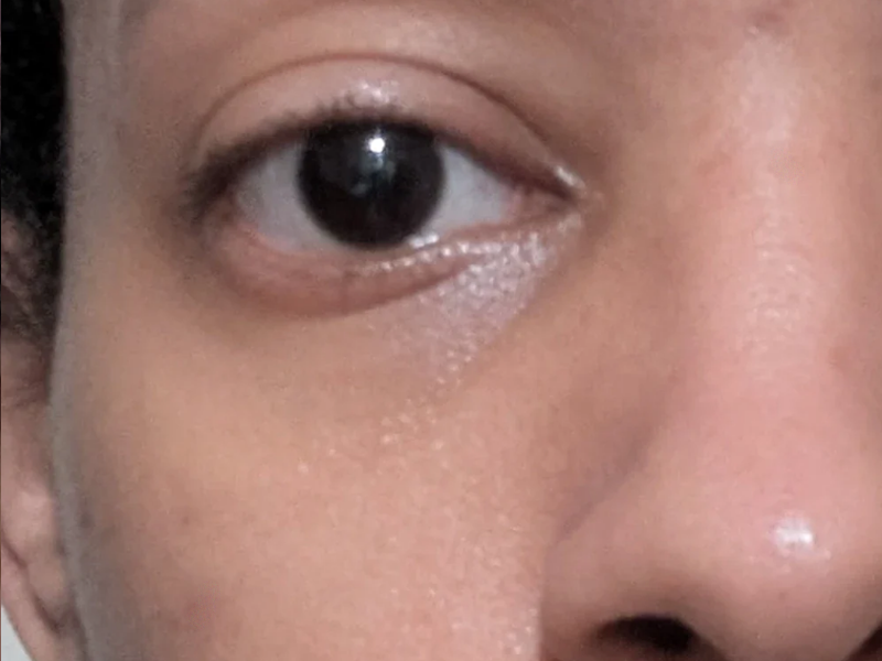brighten skin tone after using led light therapy mask