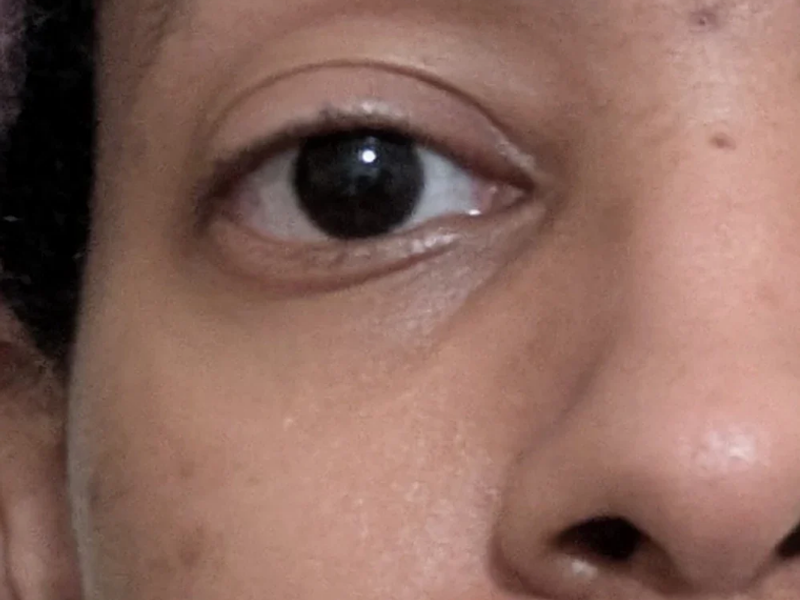 brighten skin tone before using led light therapy mask