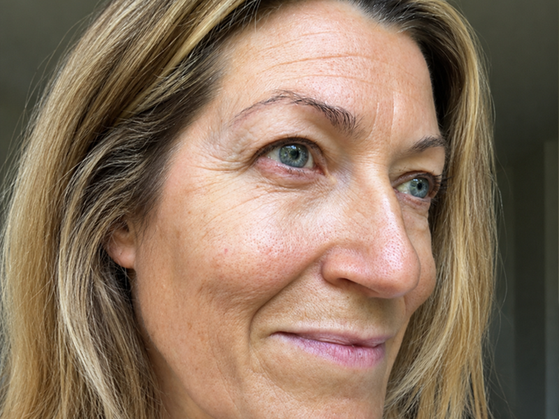 Before wireless LED light therapy mask routine for redness dullness and skin fatigue